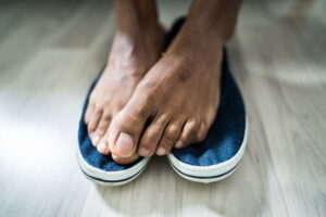 How to Know If Fungus Is Causing Your Foot Odors